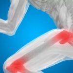 Best Supplements For Healthy Joint Function
